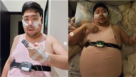 國動,統神,插管,呼吸中止症,居家睡眠檢測