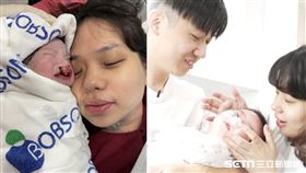 【顱顏專題】-宥晰寶寶