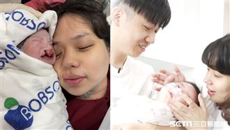 唇腭裂非孕婦的錯！顱顏兒爸：是她太趕來