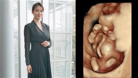 劉香慈高齡懷第3胎，遇上產檢難題。（圖／翻攝自劉香慈臉書）