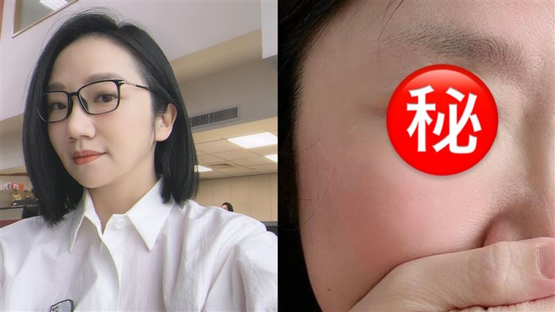陶晶瑩宣布割雙眼皮　網一看照片全笑了