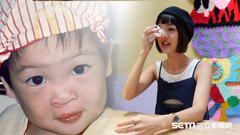 唇腭裂怪媽媽？藝術家淚謝母親付出一切