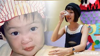 唇腭裂怪媽媽？藝術家淚謝母親付出一切