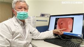 胃食道逆流（圖／翻攝畫面）