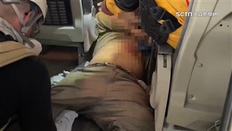 高三生斷腿裝葉克膜　家屬憂恐成植物人