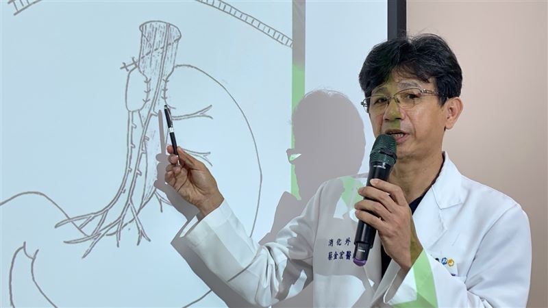 一吃就反芻！50年胃食道逆流1手術治好了