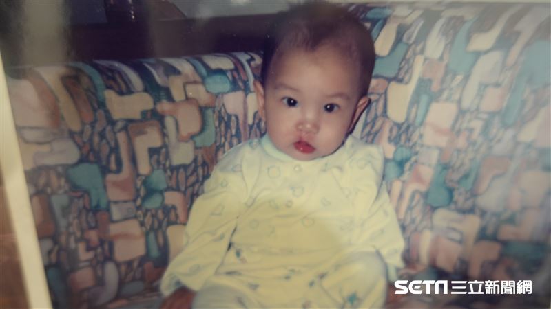 生下來唇腭裂就怪父母？他的答案打臉網友