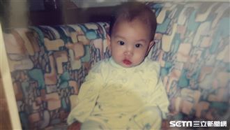 生下來唇腭裂就怪父母？他的答案打臉網友