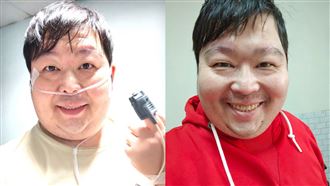 38歲山豬猝逝　昔「9病症纏身」斷氣19次