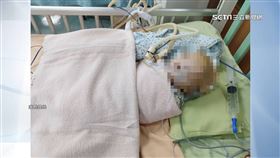 高雄5月大男嬰疑遭虐「顱骨骨折」　保母遭羈押