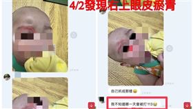 虐嬰,男嬰,保母,高雄,虐待