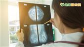 乳房良性腫瘤要拿掉？家族有風險拿掉較好