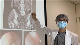 泌尿科醫師趙浩堅指出，婦人有臨床所稱「單側雙套集尿系統」，總共擁有3顆腎臟。（圖／翻攝自台中醫院官網）