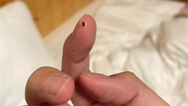 一晚4690「溫泉會館髒爆」她被跳蚤咬整晚