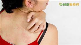 更年期階段，臨床上常見症狀為月經週期不規律、潮熱出汗、心悸、抑鬱、頻尿、胸悶、失眠等，而一大部分女性也會開始出現皮膚搔癢或是陰道搔癢的症狀。