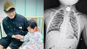 金曲客語歌王羅文裕，兒子仔仔食道卡住錢幣。（圖／翻攝羅文裕臉書）