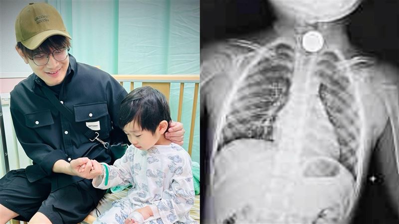 金曲歌王4歲兒誤吞錢幣！苦熬8小時驚魂記