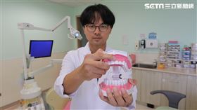 門牙,牙科,漏風,阻生齒(圖/翻攝畫面)