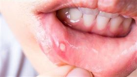 嘴破（圖／World Gym Blog提供）