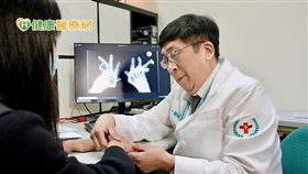 蔡長祐醫師表示如罹患類風濕性關節炎未能即時治療、獲得控制，最終恐導致指關節變形猶如「外星人手」，影響到日常生活。