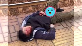 俄羅斯15歲少年爬火車頂特技表演，下體觸電，生殖器嚴重受創。（圖／翻攝每日郵報）