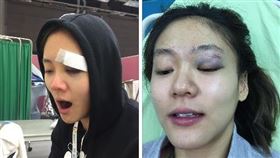 文姿云在社群平台PO出鼻青臉腫照片，讓粉絲以為她要復出。（圖／翻攝threads）