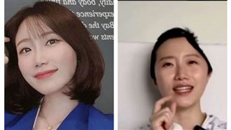 頭蓋骨被削　美女空姐跌倒撞頭最新近況曝