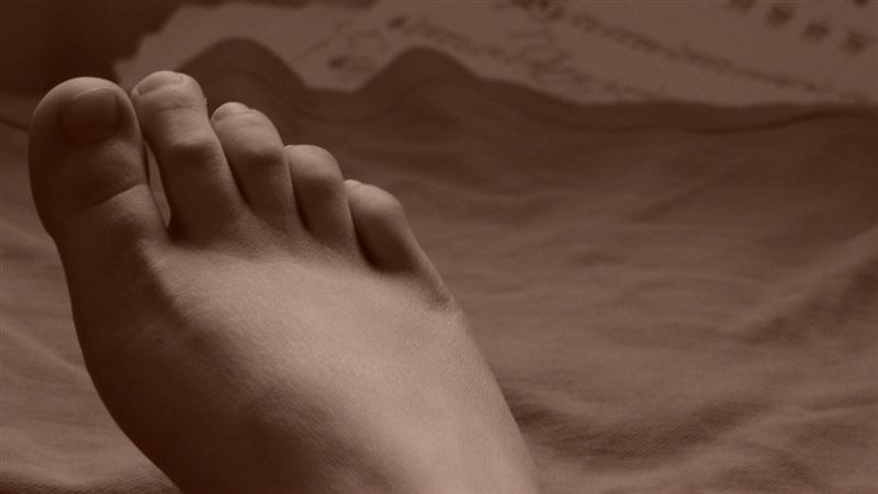 她腳底長痣慘罹最惡癌症　醫嘆：整塊爛掉