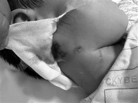 哈士奇發狂殺人！3歲童遭咬搶救18天不治（圖／翻攝微博）