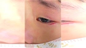 台中,潭雅神綠園道,溜滑梯,幼童,眼角,受傷（圖／台中市議員周永鴻提供）