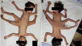 （圖／翻攝自美國醫學期刊）