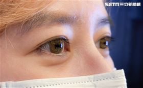 台南,奇美醫院,眼球,揉眼睛,手術