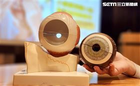 台南,奇美醫院,眼球,揉眼睛,手術