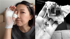 余皓然,王中平,韓菲,濺血意外,急診室