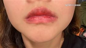 花3千當霧唇模特兒 女控成香腸嘴