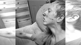 美國,少年,黑熊,看電視,攻擊（圖／翻攝Facebook）