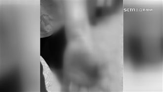 過當體罰頻傳！女童未交作業遭老師打瘀青