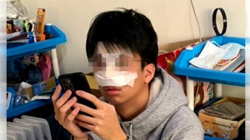 名高中學生被打斷鼻樑！校方遭控搓圓仔湯