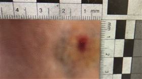 北投疑似有民眾遭BB彈射傷。（圖／翻攝畫面）