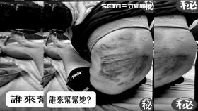 台中2寶媽遭狠夫鐵鎚暴毆「恐怖傷痕曝」（圖／翻攝畫面）