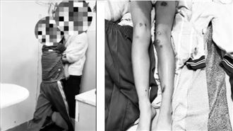 新北某國小師虐童超過半年　教育局說話了