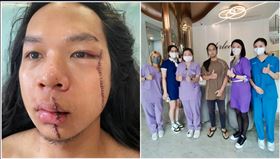 「中捷長髮哥」不後悔肉搏歹徒醫美贊助手術去除「蜈蚣疤」（業配勿用）