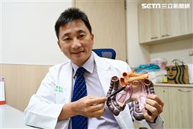 每天暴瘦1公斤！台中婦患罕見十二指腸癌（圖／亞大提供）