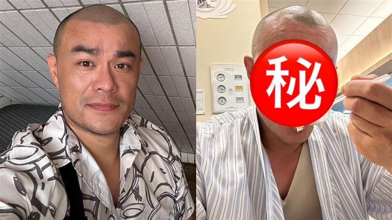 《星光》男星滿臉瘀青　好友驚喊：誰打的