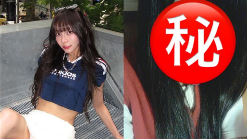 林襄做醫美挨酸　「12年前舊照」再被挖