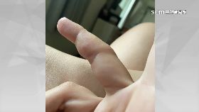 文 琉海膽刺傷1800