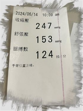 一名男子的收縮壓247 毫米汞柱、舒張壓153、脈搏數每分鐘124次，相當驚人。(圖/取自陳冠任醫師的臉書)
