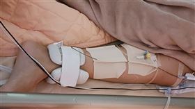 蒙古女左下肢急性栓塞  飛到台灣求診蒙古1名27歲女子因左下肢急性栓塞，在蒙古及中國北京治療未見改善，4月時經由國際醫療轉介到員榮醫院接受手術治療，近日透過視訊看診已恢復良好。（員榮醫院提供）中央社記者鄭維真傳真  113年6月26日