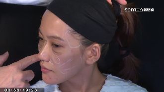 台灣18歲才能做醫美　畢業生最愛微整形