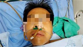 15歲兒子誤食有毒蘑菇命危。（圖／翻攝自微博）